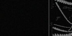 《REPOSE》下载安装教程介绍